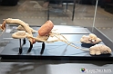VBS_2570 - Prostata ingrossata - Mostra Body Worlds